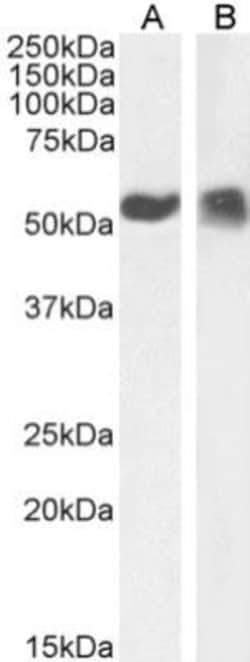 p53 Antibody (PAb421) - Chimeric - Azide and BSA Free, Novus Biologicals