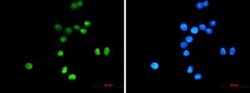 p53 Antibody (S07-6A7), Novus Biologicals 50 &mu;g; Unconjugated:Antibodies,