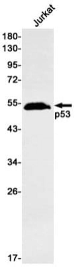 p53 Antibody (S07-6A7), Novus Biologicals 50 &mu;g; Unconjugated:Antibodies,