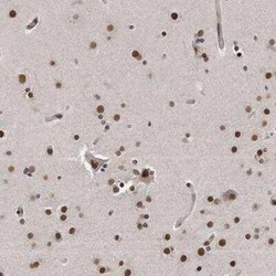 p53 DINP1 Antibody, Novus Biologicals:Antibodies:Primary Antibodies