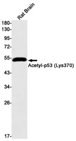 p53, ac Lys370 Antibody (S06-7C9), Novus Biologicals:Antibodies:Primary