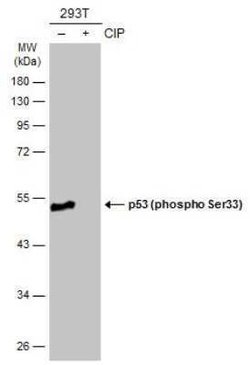 p53, p Ser33 Antibody, Novus Biologicals 100 &mu;g | Buy Online | Novus Biologicals | Fisher Scientific