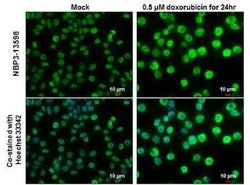 p53, p Ser46 Antibody (GT1018), Novus Biologicals 100 &mu;g; Unconjugated:Antibodies,