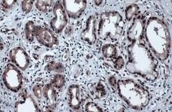p53, p Ser46 Antibody (GT1018), Novus Biologicals 100 &mu;g; Unconjugated:Antibodies,