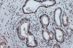 p53, p Ser46 Antibody (GT1018), Novus Biologicals 100 &mu;g; Unconjugated:Antibodies,