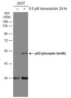 p53, p Ser46 Antibody (GT1018), Novus Biologicals 100 &mu;g; Unconjugated:Antibodies,