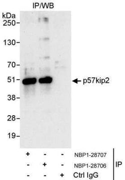 p57 Kip2 Antibody, Novus Biologicals 100 &mu;g; Unconjugated:Anticuerpos