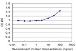 p62/SQSTM1 Antibody (1C9), Novus Biologicals 0.1 mg, Unconjugated:Antikörper