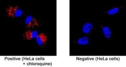 p62/SQSTM1 Antibody (2533B) - BSA Free, Novus Biologicals 0.025 mg, Unconjugated:Antibodies,