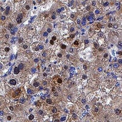 p62/SQSTM1 Antibody (2533B) - BSA Free, Novus Biologicals 0.025 mg, Unconjugated:Antibodies,