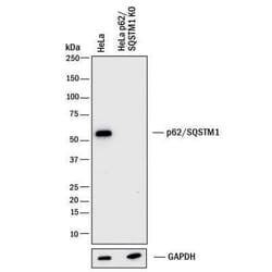 p62/SQSTM1 Antibody (2533B) - BSA Free, Novus Biologicals 0.025 mg, Unconjugated:Antibodies,