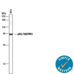 p62/SQSTM1 Antibody (2533B) - BSA Free, Novus Biologicals 0.025 mg, Unconjugated:Antibodies,