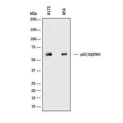 p62/SQSTM1 Antibody (2533B) - BSA Free, Novus Biologicals 0.025 mg, Unconjugated:Antibodies,