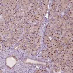 p62/SQSTM1 Antibody, Novus Biologicals 100 &mu;g; Unconjugated:Antibodies,