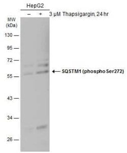 p62/SQSTM1, p Ser272 Antibody, Novus Biologicals 100 &mu;g | Buy Online | Novus Biologicals | Fisher Scientific