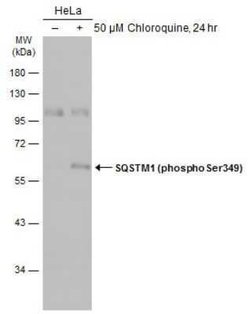 p62/SQSTM1, p Ser349 Antibody, Novus Biologicals 100 &mu;g | Buy Online | Novus Biologicals | Fisher Scientific