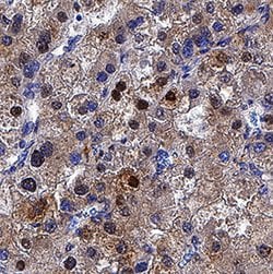 Human p62/SQSTM1 Antibody, R D Systems 25 &mu;g; Unconjugated:Antibodies,