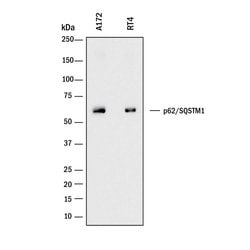 Human p62/SQSTM1 Antibody, R D Systems 25 &mu;g; Unconjugated:Antibodies,