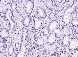 p63/TP73L Rabbit anti-Human, Clone: 143, Novus Biologicals:Antibodies:Primary