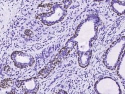 p63/TP73L Rabbit anti-Human, Clone: 143, Novus Biologicals:Antibodies:Primary
