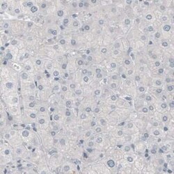 p63/TP73L Antibody (CL3748), Novus Biologicals:Antibodies:Primary Antibodies
