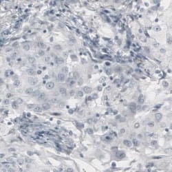 p63/TP73L Antibody (CL3748), Novus Biologicals:Antibodies:Primary Antibodies