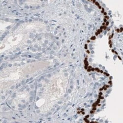 p63/TP73L Antibody (CL3748), Novus Biologicals:Antibodies:Primary Antibodies