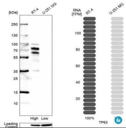 p63/TP73L Antibody (CL3748), Novus Biologicals:Antibodies:Primary Antibodies