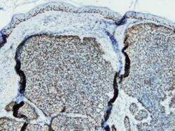 p63/TP73L Antibody (I27-I), Novus Biologicals 100 &mu;g; Unconjugated:Antibodies,