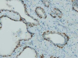 p63/TP73L Antibody (I27-I), Novus Biologicals 100 &mu;g; Unconjugated:Antibodies,