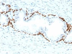 p63/TP73L Antibody (TP63/2428), Novus Biologicals:Antibodies:Primary Antibodies