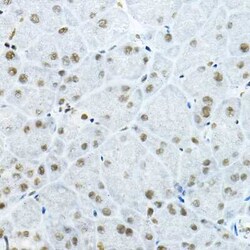 p66 beta Antibody - BSA Free, Novus Biologicals 0.1 mL, Unconjugated:Antibodies,