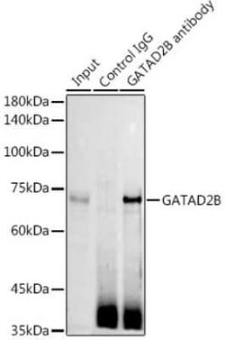 p66 beta Antibody - BSA Free, Novus Biologicals 0.1 mL, Unconjugated:Antibodies,