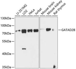 p66 beta Antibody - BSA Free, Novus Biologicals 0.1 mL, Unconjugated:Antibodies,
