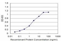 p70 S6 Kinase/S6K Antibody (4H4), Novus Biologicals 0.1 mg, Unconjugated:Anticorps,
