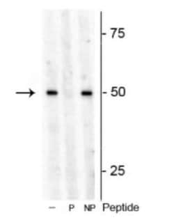 p70 S6 Kinase/S6K Rabbit anti-A. thaliana, Polyclonal, Novus Biologicals