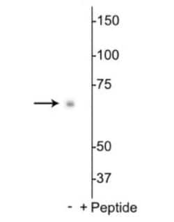 p70 S6 Kinase/S6K Rabbit anti-Drosophila, Polyclonal, Novus Biologicals:Antibodies:Primary