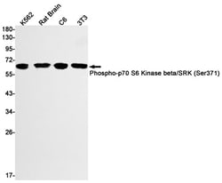 p70 S6 Kinase beta/S6K2, p Ser371 Antibody (S01-4A5), Novus Biologicals:Antibodies:Primary