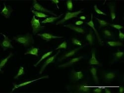p97/VCP Antibody (2H5), Novus Biologicals 0.1 mg, Unconjugated:Antibodies,