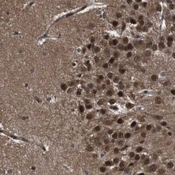 p97/VCP Antibody, Novus Biologicals:Antibodies:Primary Antibodies