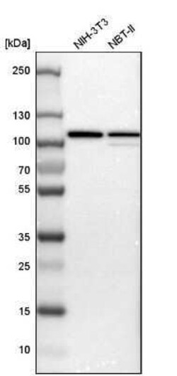 p97/VCP Antibody, Novus Biologicals:Antibodies:Primary Antibodies
