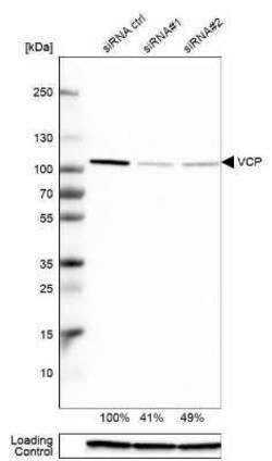 p97/VCP Antibody, Novus Biologicals:Antibodies:Primary Antibodies
