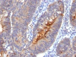 ECM-1/Secretory Component P85 Antibody (SC05), Novus Biologicals:Anticuerpos:Anticuerpos