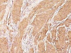 Actin (Muscle Specific) Antibody (SPM160) - Azide and BSA Free, Novus Biologicals