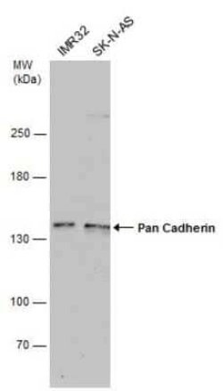 pan Cadherin Antibody (GT2610), Novus Biologicals 100 &mu;g | Buy Online | Novus Biologicals | Fisher Scientific