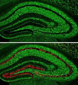 pan-Synuclein Antibody, Novus Biologicals 100 &mu;g | Buy Online | Bio-Techne | Fisher Scientific