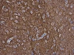 pan-Synuclein Antibody, Novus Biologicals 100 &mu;g | Buy Online | Bio-Techne | Fisher Scientific