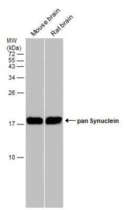 pan-Synuclein Antibody, Novus Biologicals 100 &mu;g | Buy Online | Bio-Techne | Fisher Scientific