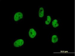 pre-mRNA cleavage factor I (59 kDa subunit) Antibody, Novus Biologicals 0.05 mg | Buy Online | Novus Biologicals | Fisher Scientific