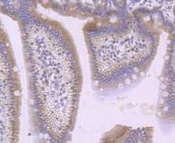 sFRP-1 Antibody 100 &mu;L | Buy Online | Novus Biologicals | Fisher Scientific